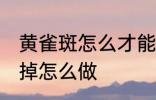 黄雀斑怎么才能消除掉 黄雀斑想消除掉怎么做